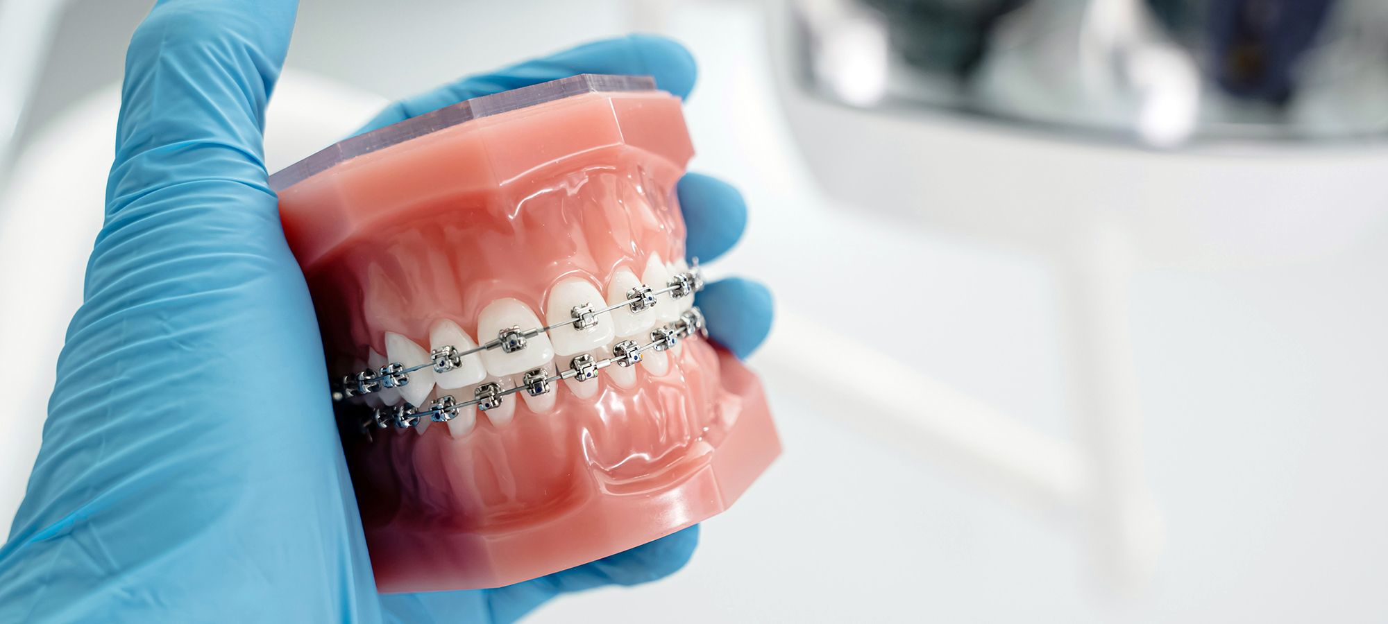 Teeth with braces