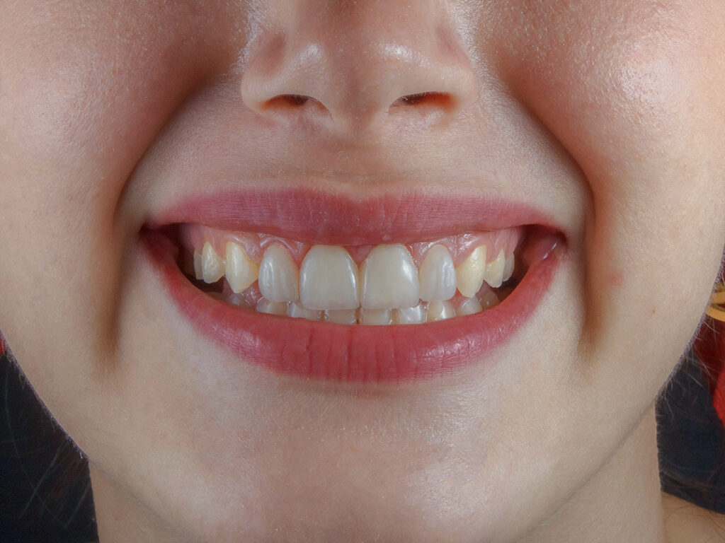 Close up of teeth