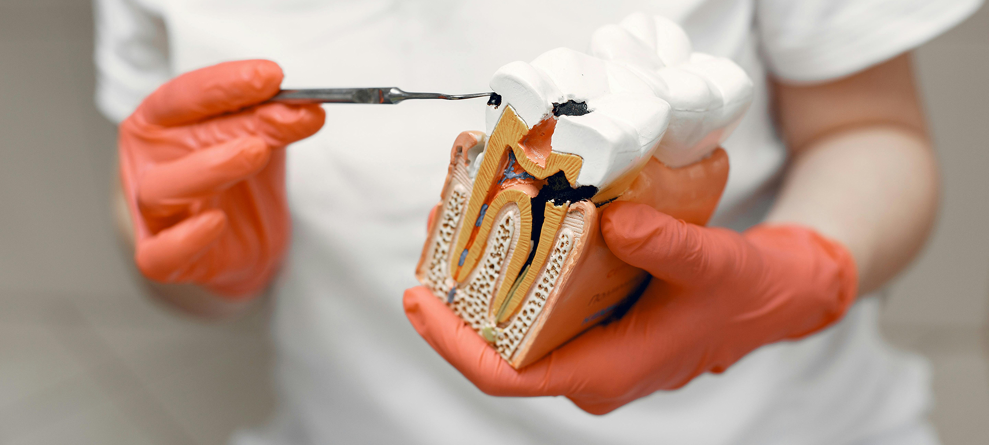 Dental tooth model
