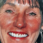 Close portrait of a smiling woman displaying beautifully aligned, natural-looking implant crown restorations by an expert implant dentist in Sunnyvale.