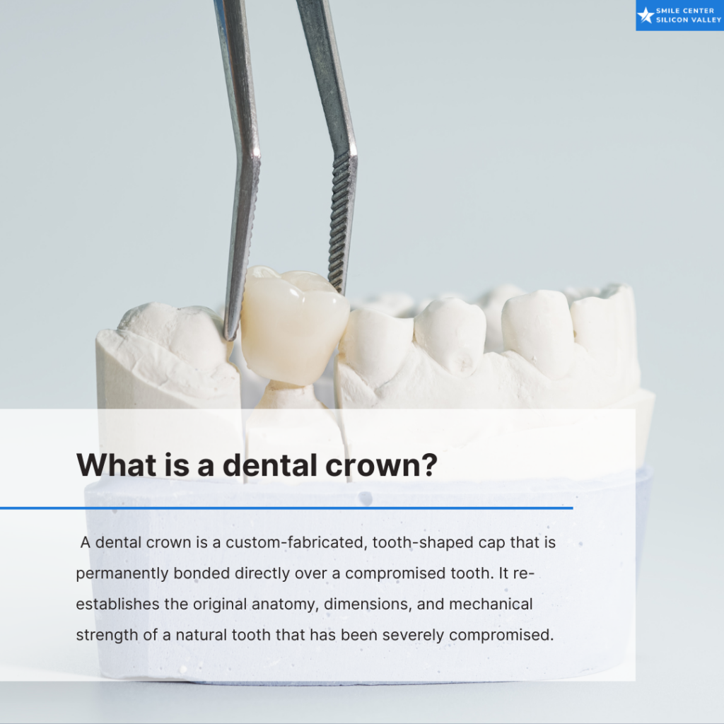 dental crown