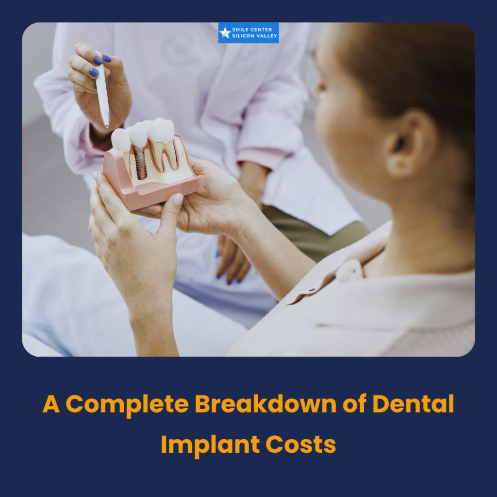 A close-up view of a dental implant model showcasing the titanium root post, custom abutment connector, and ceramic crown on a clean clinical display.